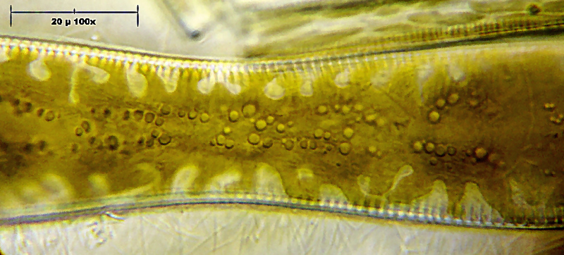 particolari di Cymatopleura solea