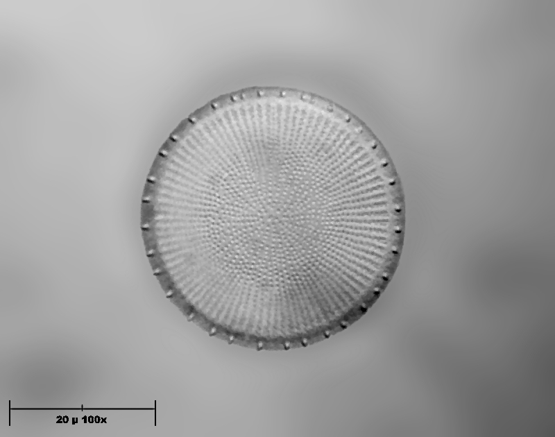 Stephanodiscus sp.  BN