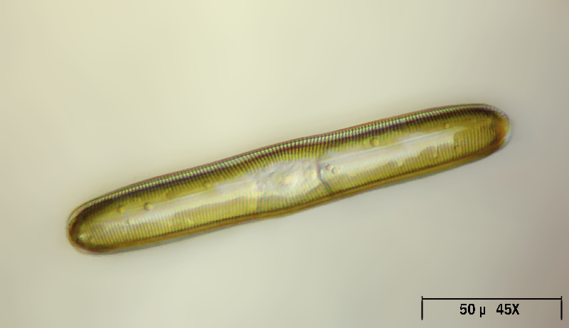 Pinnularia sp.