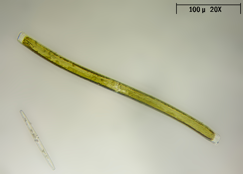 Nitzschia sigmoide