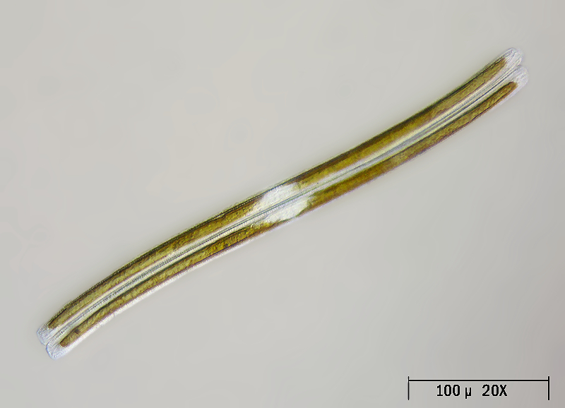 Nitzschia sigmoide