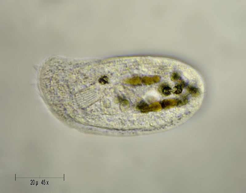 Nassula sp. ??????  [ Chilodonella ]