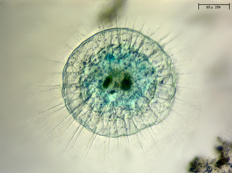 Actinosphaerium eichhorni