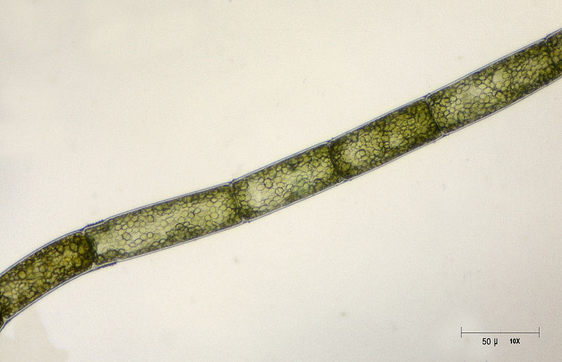 Oedogonium sp. ?