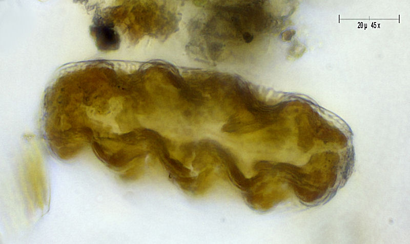 Cymatopleura elliptica