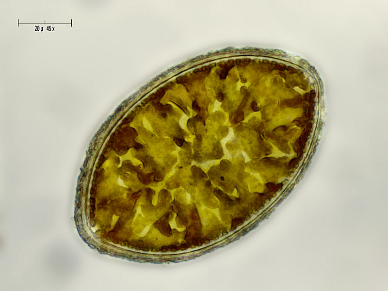 Cymatopleura elliptica