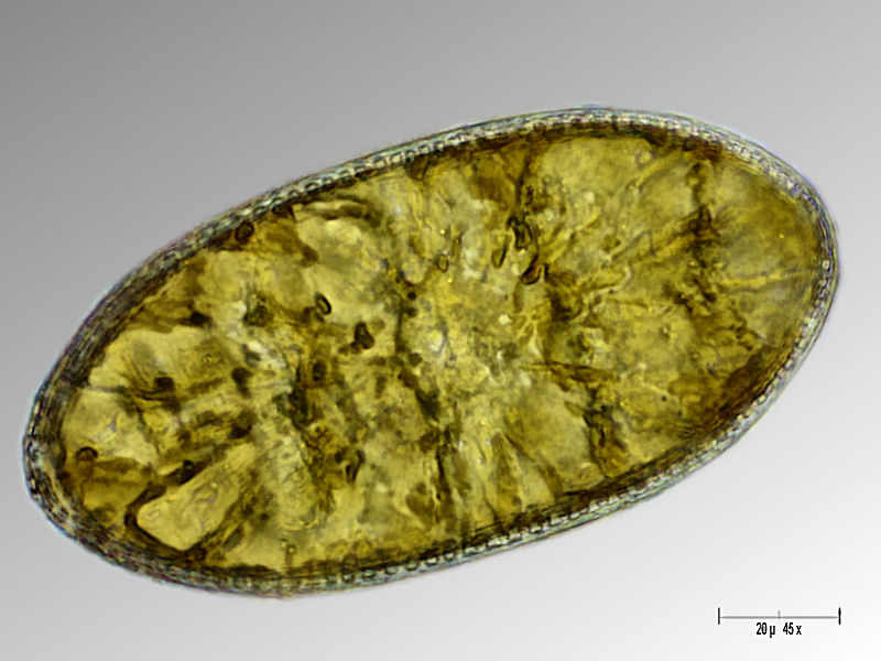 Cymatopleura elliptica 2