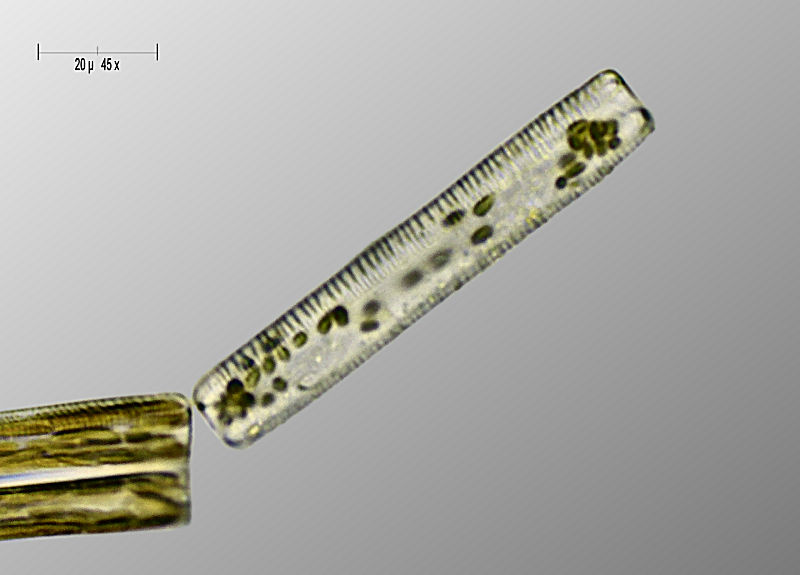 Tabellaria sp.