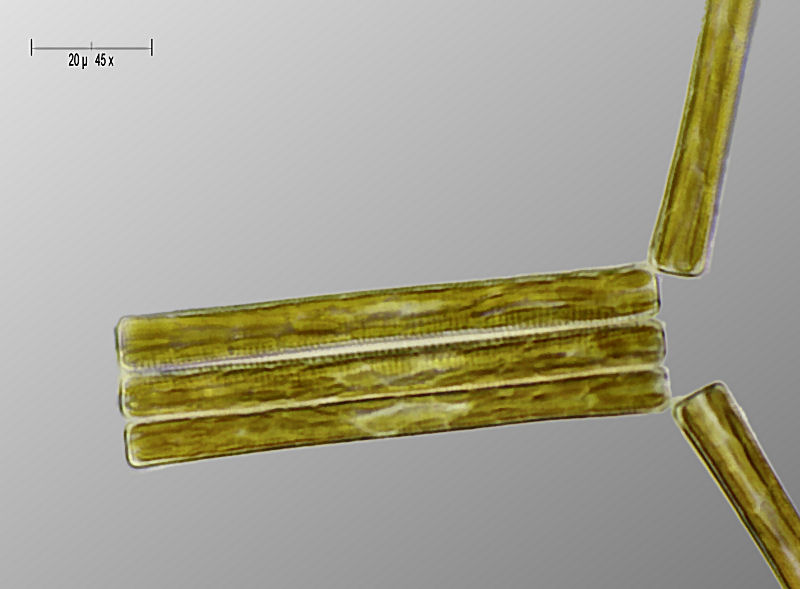 Tabellaria sp.