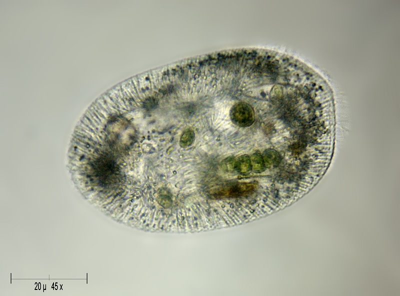 ciliato,  ma quale ? [ Frontonia sp. ]