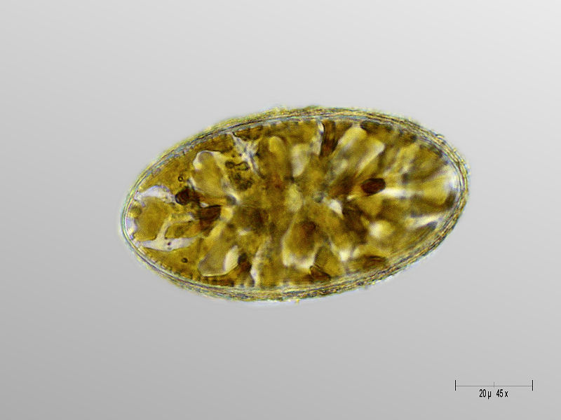 Cymatopleura elliptica
