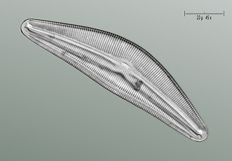 Cocconema gastroides