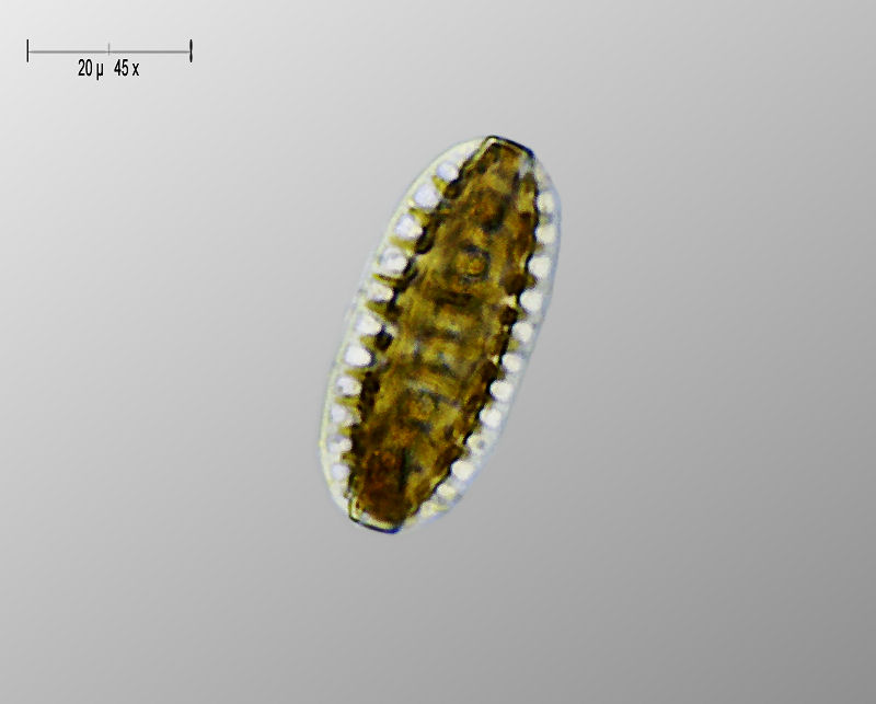 Surirella sp.