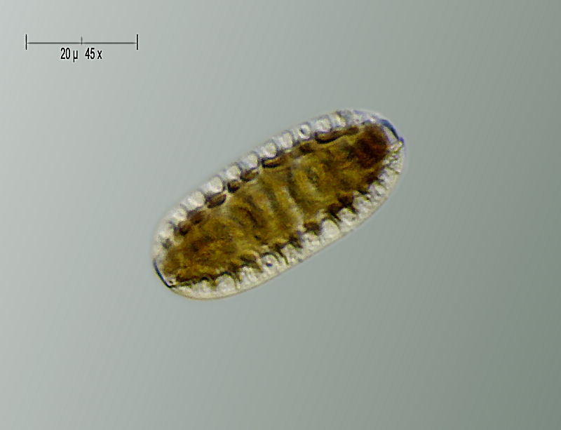 Surirella sp.