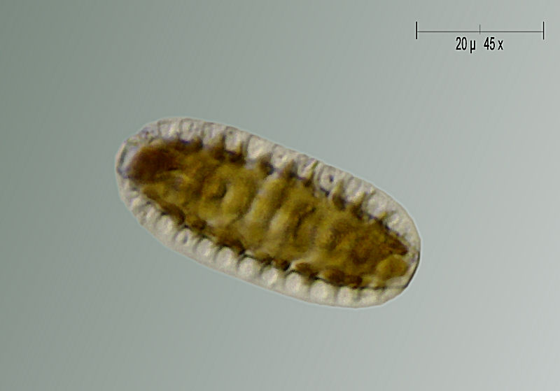 Surirella sp.