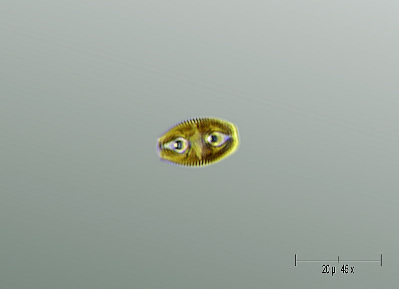 due occhietti simpatici - Amphora ovalis