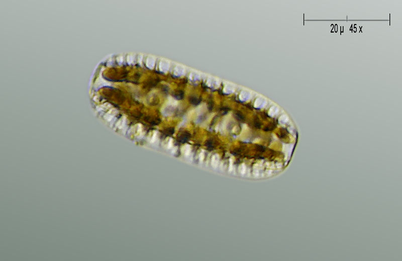 Surirella sp.