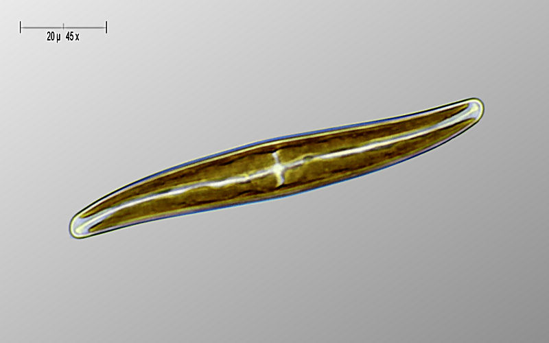 Pleurosigma sp.