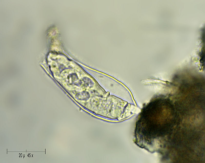 Cothurnia sp.