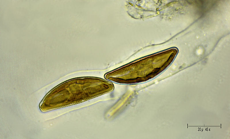 Encyonema sp.