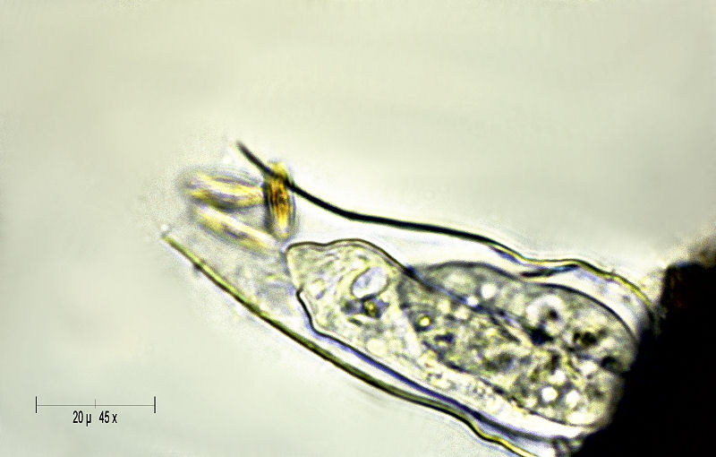 Vaginicola sp.