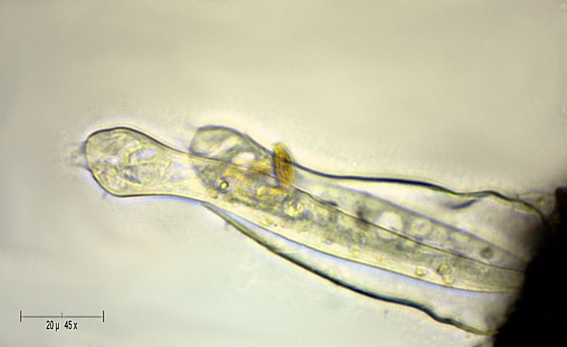 Vaginicola sp.