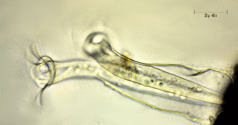 Vaginicola sp.