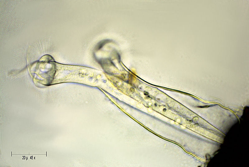 Vaginicola sp.