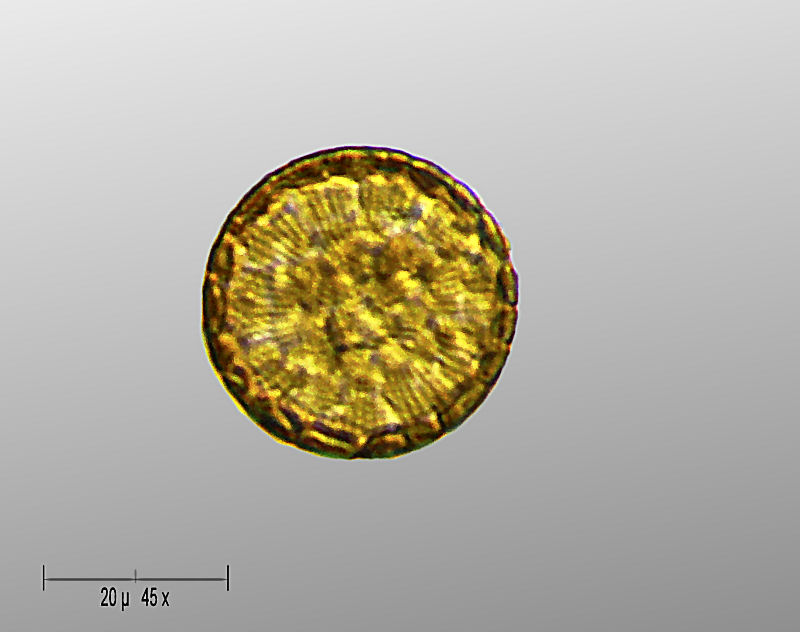Cyclotella sp.
