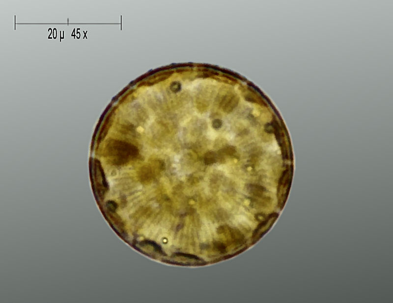 Cyclotella sp.