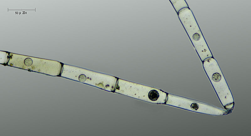 Ulothrix sp.  - nuclei ?