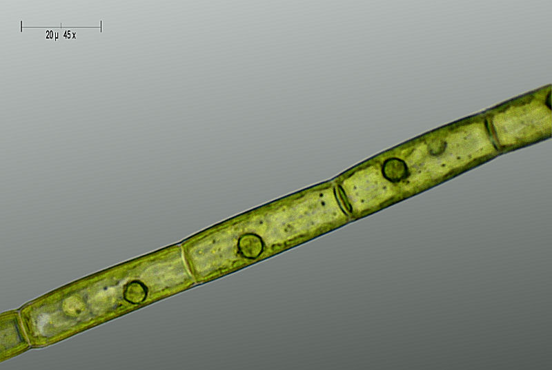 Ulothrix sp.  - nuclei ?