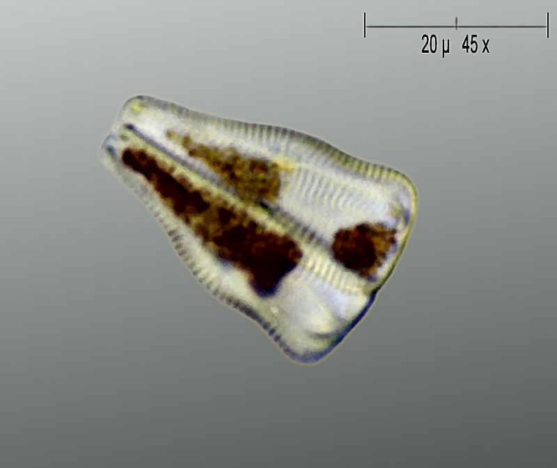Gomphonema sp. ?
