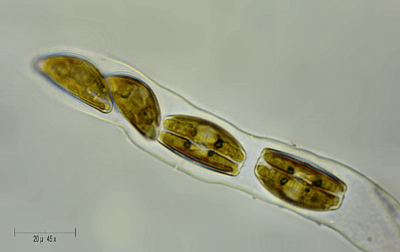 Encyonema sp.