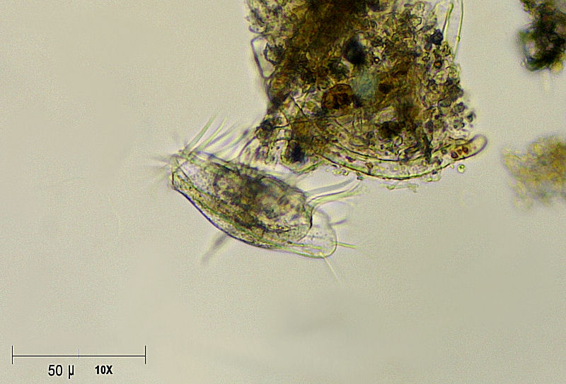 Euplotes sp.