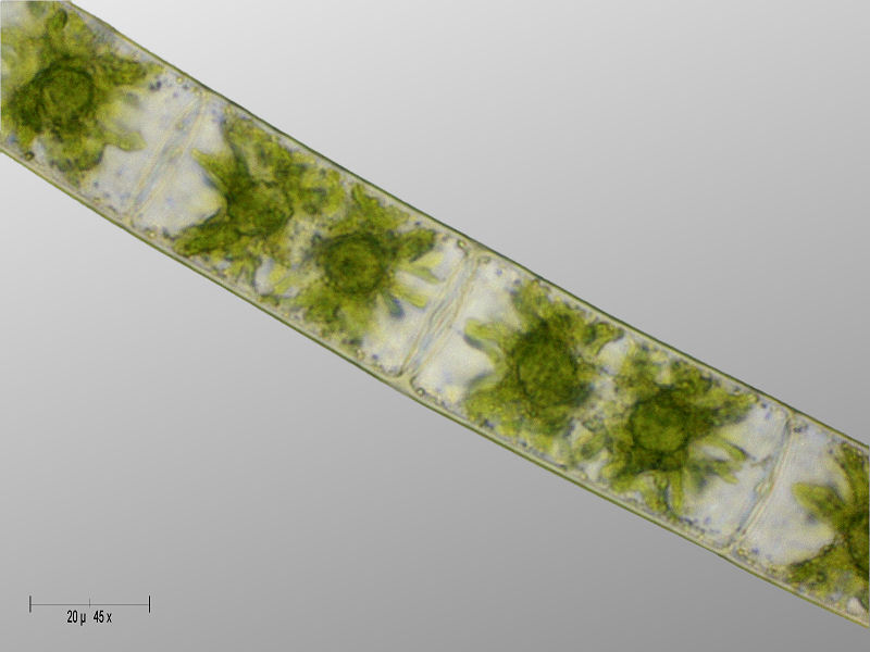 Zygnema sp.