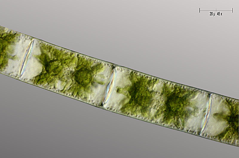 Zygnema sp.