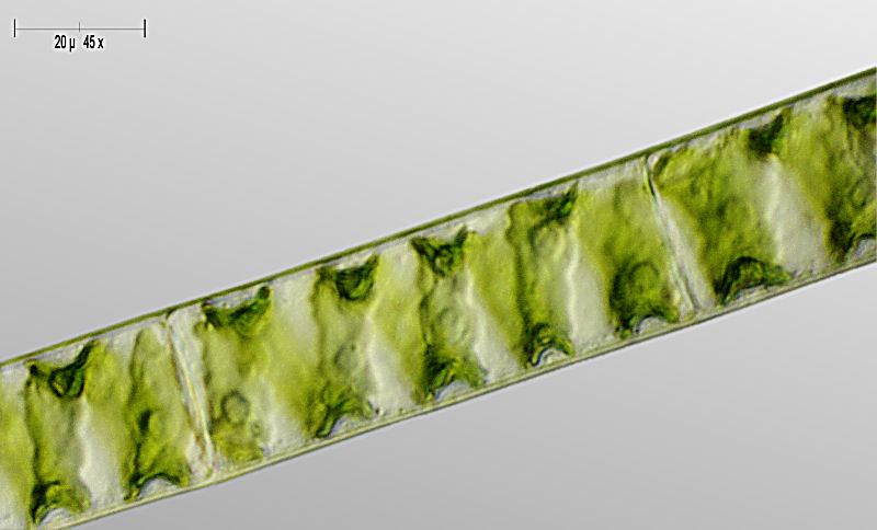 Spirogyra sp. -  le spire