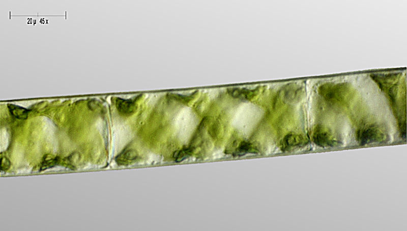 Spirogyra sp. -  le spire