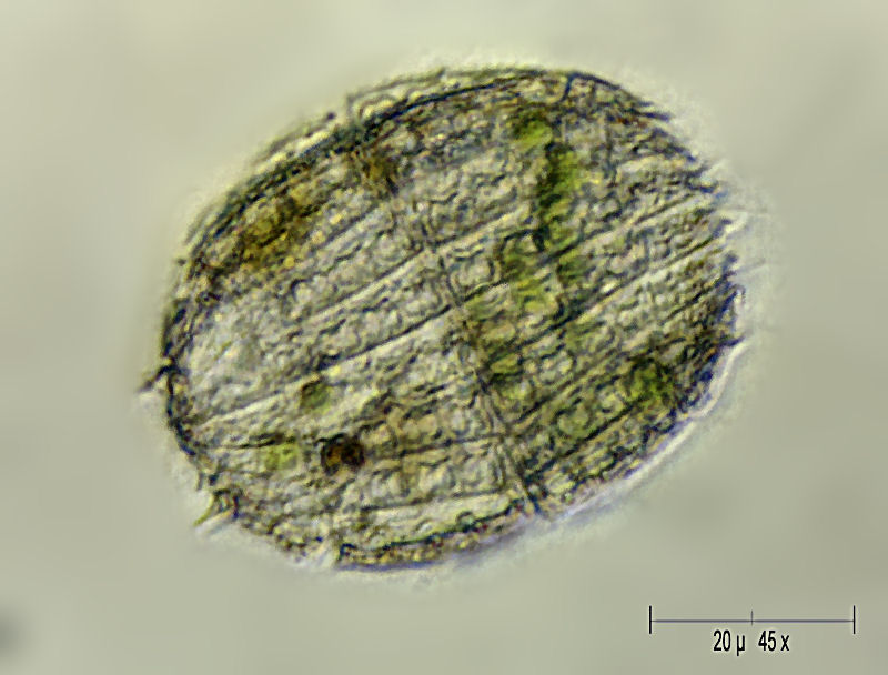Coleps hirtus
