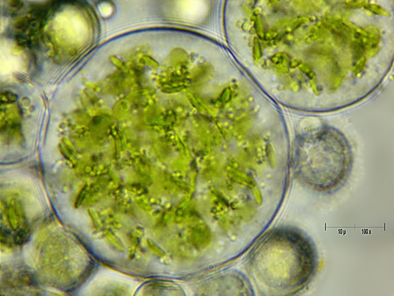Chlorococcum sp.