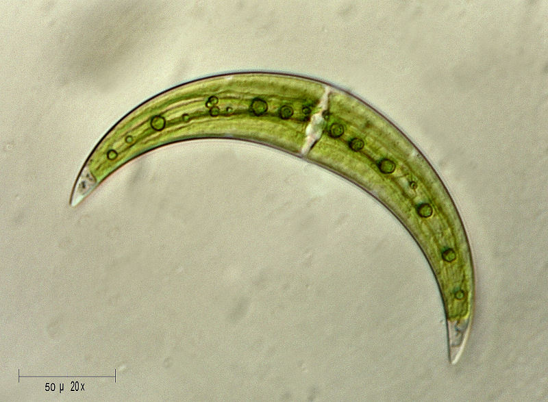 Closterium leibleinii