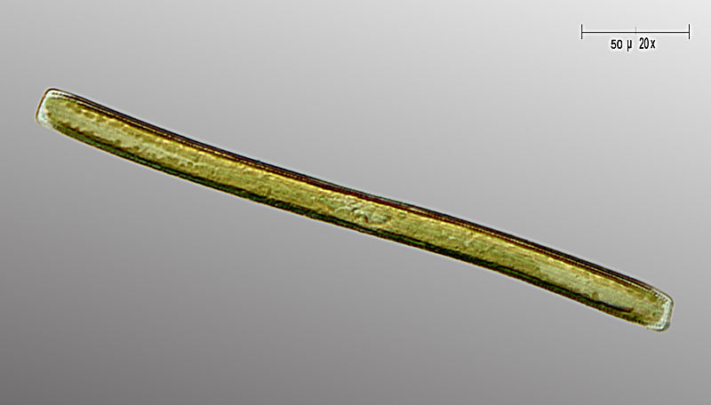 Nitzschia sigmoidea