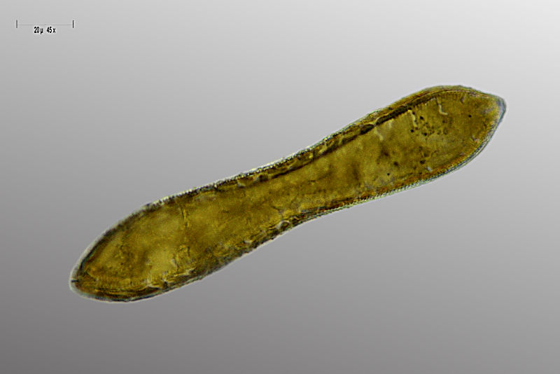 Cymatopleura solea