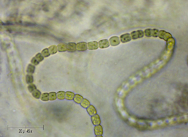 groviglio di cianobatteri