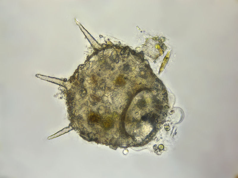 Centropyxis aculeata
