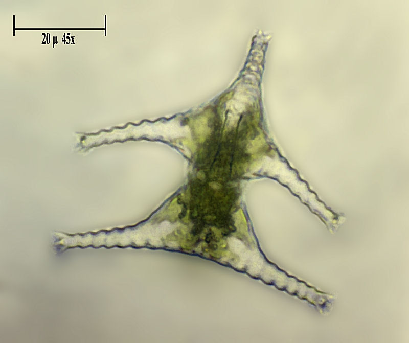Staurastrum gracile