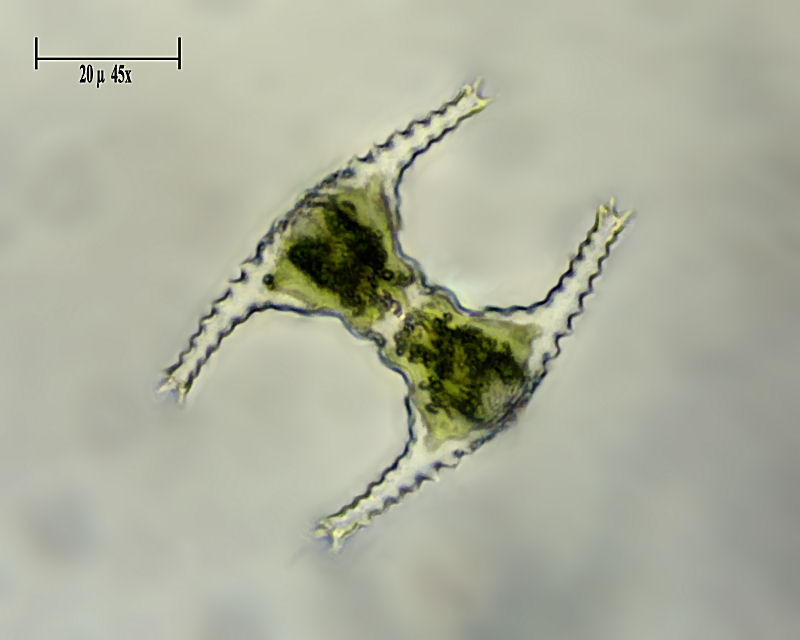 Staurastrum gracile