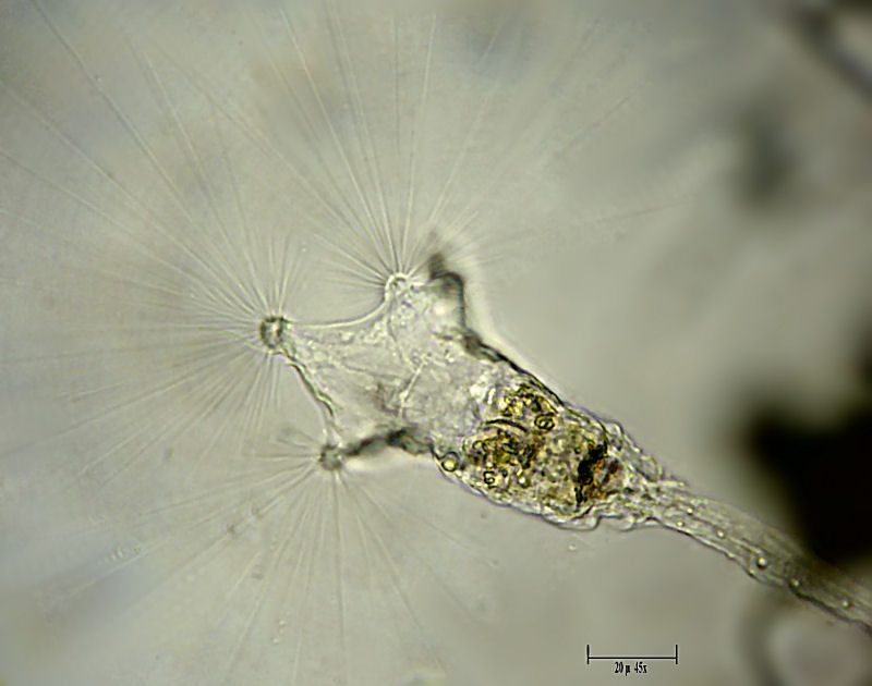 un rotifero dalle cilia lunghissime - Collotheca sp.