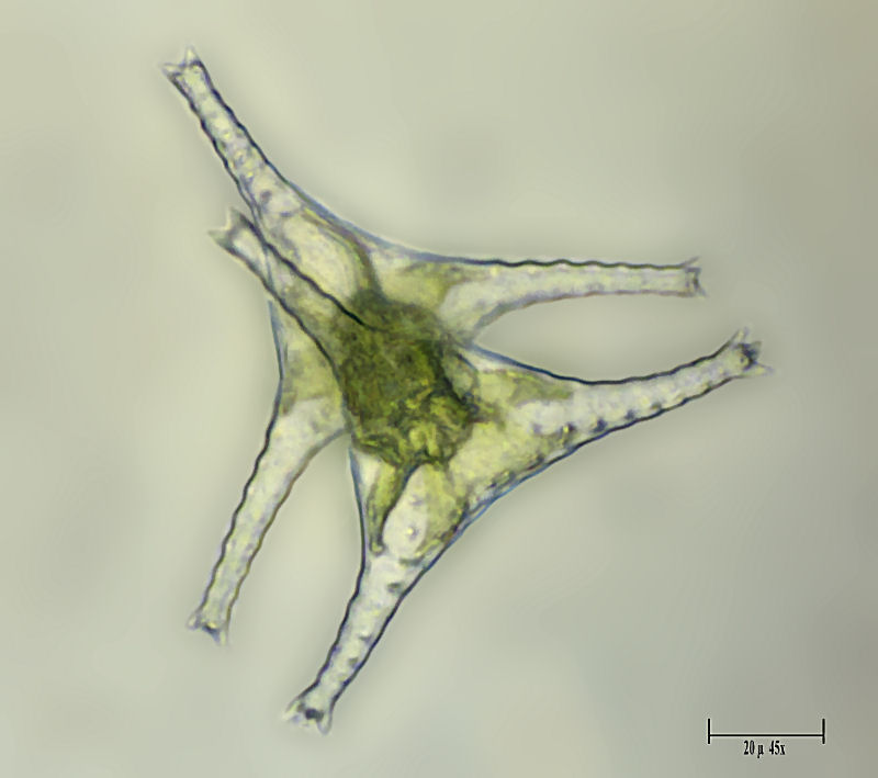 Staurastrum gracile